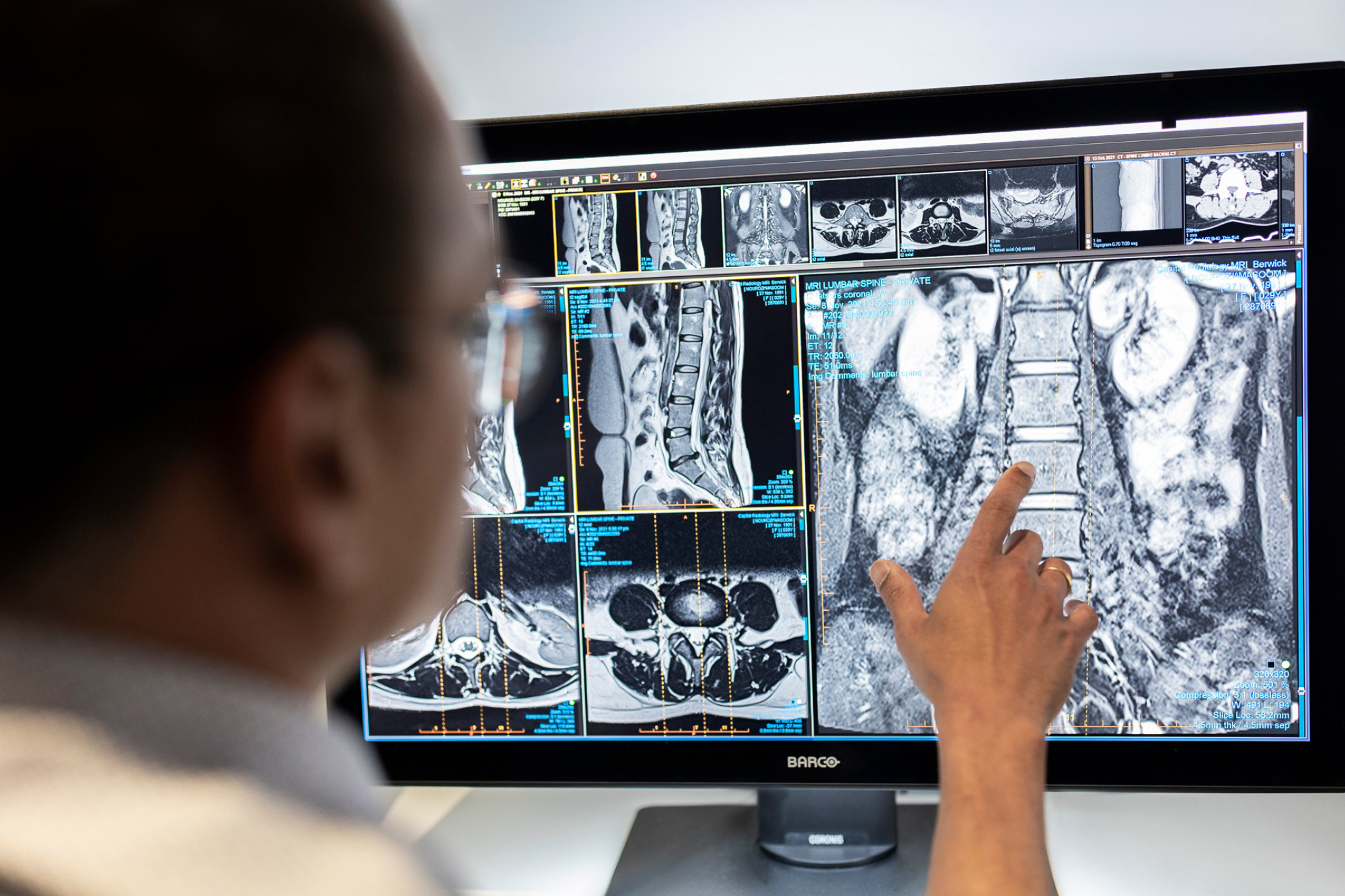 Lumbar Spine MRI Result on Computer Screen | Medical Imaging Services | FMIG