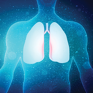 The X Ray Group Lung Cancer Awareness